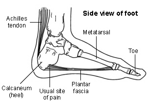 Plantar Fasciitis Injection Complications