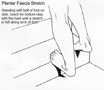 Plantar Fasciitis Stretches Exercises